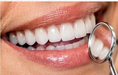 Sorriso com dentes de aparência natural